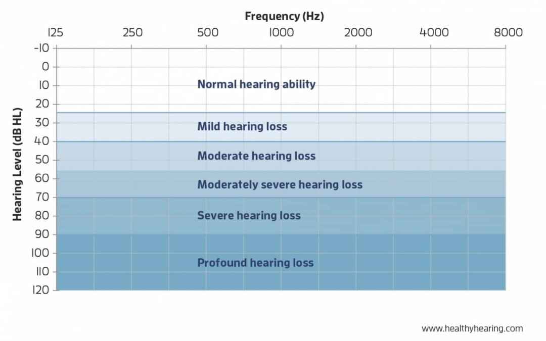 Ani İşitme Kaybı Nedir?