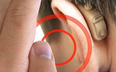 İşitme cihazlarının ötmesi neden kaynaklanır?