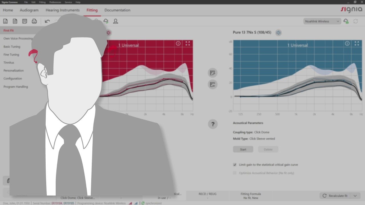 İşitme Cihazı Ayar